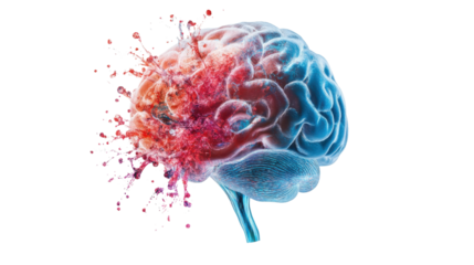 Human brain exploding on transparent background representing mental health issues