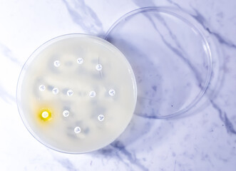 Antimicrobial susceptibility testing in petri dish. Antibiotic resistance test of bacteria.