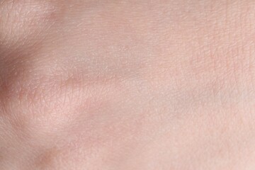 Texture of healthy skin as background, closeup