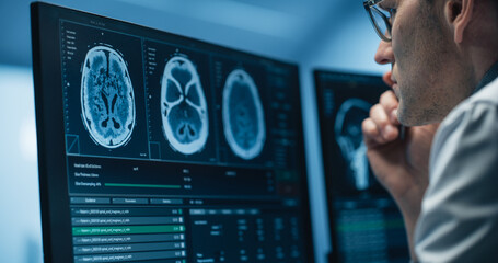 Neurologist Examines Intricate Brain Scans on Multiple Screens. Advanced Neuroimaging Technology Reveals Complex Neural Pathways, Display Showing CT Scan in a Modern Medical Environment