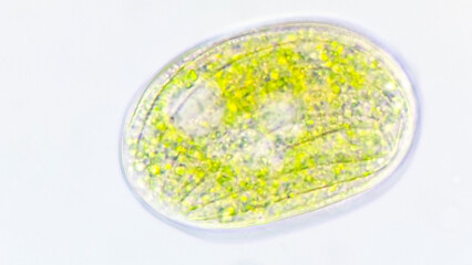 Pseudomicrothorax sp., a freshwater cilliate collected from the pond. Stacked photo