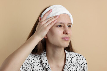 Teenage girl touching pimple on her face against beige background. Acne problem