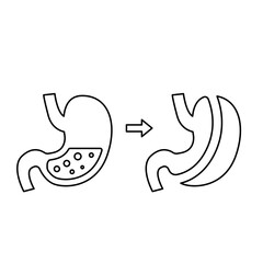 Fototapeta premium Gastrectomy