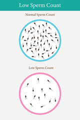 comparison of normal sperm and low sperm count. medical illustration