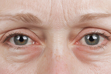 Close-up of eyes with fine wrinkles