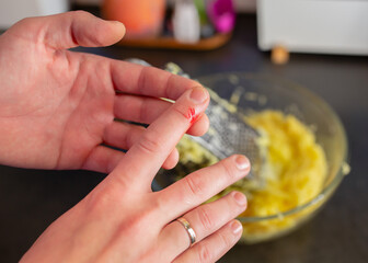 A man hand with a cut on the finger, caused by grating food. A drop of blood on the skin. In the...