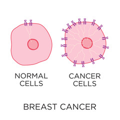 Vector Breast Cancer Normal And Cancer Cells Icon