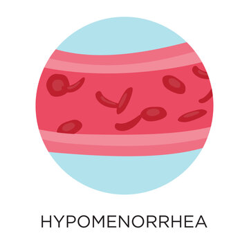 Vector Hypomenorrhea Icon