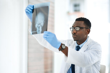 Black man, doctor and xray in hospital for healthcare, neurology or brain cancer diagnosis. Radiologist, skull image or research in clinic for surgery planning, aneurysm analysis or medical knowledge