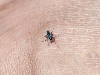Aedes mosquito sucking blood on human skin, blurred natural background.