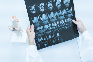 Doctor holding patient bone x-ray film before surgery.Image MRI and CT scan at radiology orthopedic...