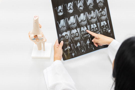 Doctor holding patient bone x-ray film before surgery.Image MRI and CT scan at radiology orthopedic department in hospital.Knee join xray for treatment.Physical therapy concept.Selective focus.