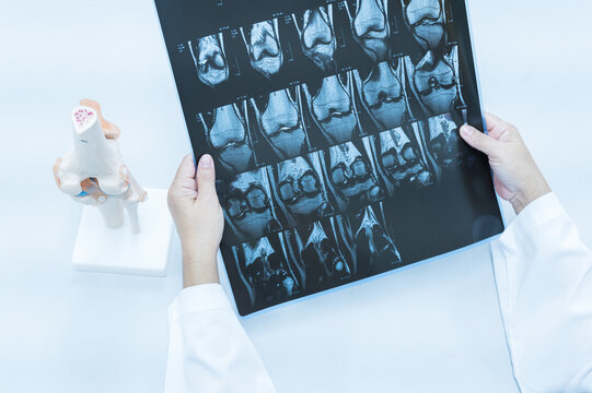 Doctor holding patient bone x-ray film before surgery.Image MRI and CT scan at radiology orthopedic department in hospital.Knee join xray for treatment.Physical therapy concept.Selective focus.