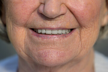 Elderly Woman's Genuine Smile