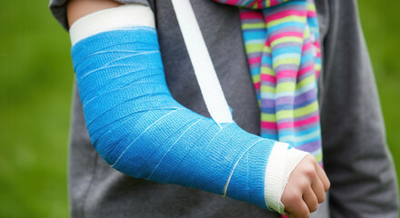 Obraz premium Child with a blue cast on their arm, showcasing resilience and recovery