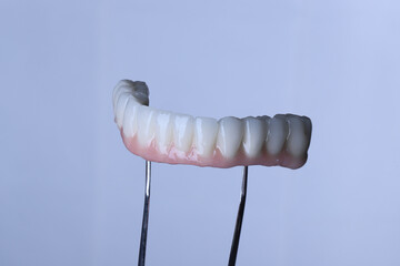 Dental implant supported full arch porcelain dental prosthesis for edentulous jaws in dentistry....