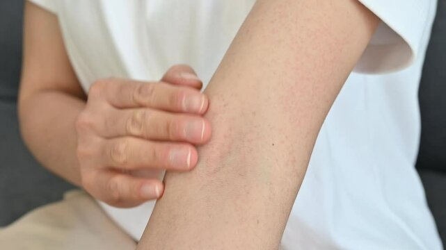 Woman scratching her arm becaused of rashes occur on skin. Skin rashes can be red, inflamed, bumpy as well as dry, itchy or painful.
