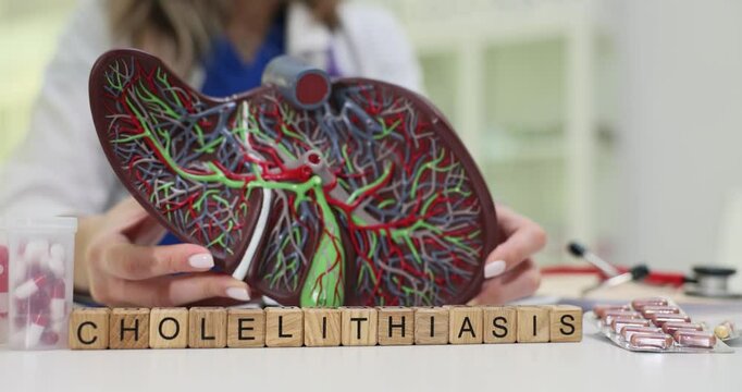 An anatomical model depicting the liver along with the vascular system, with an emphasis on cholelithiasis