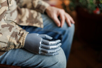Military veteran with prosthetic hand sitting in chair