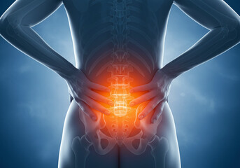 腰の痛み｜患部｜イラスト素材｜Lower back pain | Affected area | Woman | Illustration material