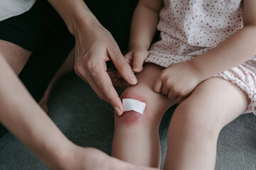 close-up of a child's scraped knee, slightly red and bruised, as an adult gently applies antiseptic