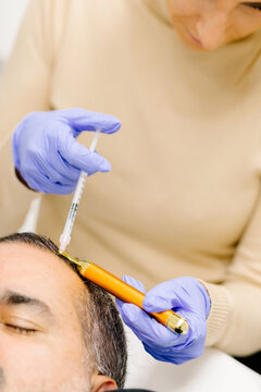 Patient undergoing preventive capillary mesotherapy into his scalp
