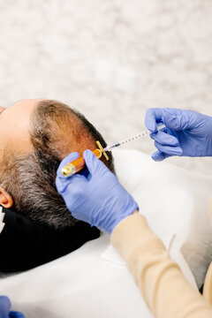 Male patient undergoes preventive treatment for hair loss