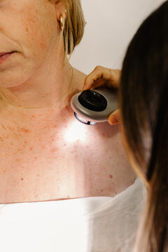Expert dermatologist looking with a dermatoscope at skin lesions