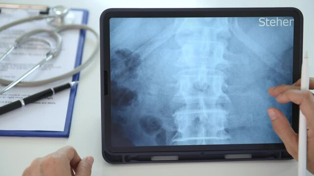 doctor or radiologic technologist diagnose spine lumber vertebrae x-ray image on digital tablet for diagnose Herniated disc disease.