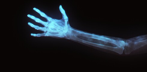 Fototapeta premium X-ray of a child or children in the orthopedic surgery unit