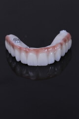 dental prosthetics veneers implant