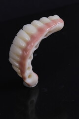 dental prosthetics veneers implant