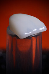 dental prosthesis veneers implant
