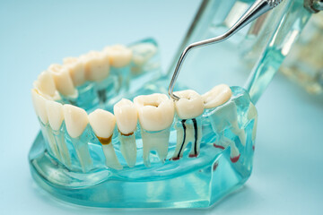 Dental teeth model with dentist tool for dentistry.