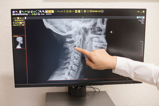 Close up of doctor pointing at x-ray on computer