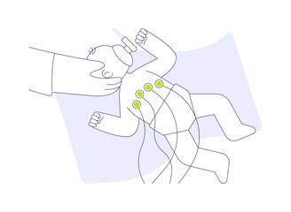 Neonatal surgery abstract concept vector illustration.