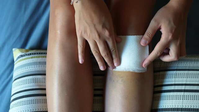 Female leg with sutured wound below the left knee being bandaged and supported by a striped pillow