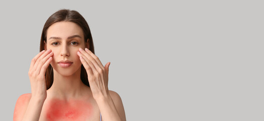 Beautiful young woman with red sunburned skin applying cream on grey background