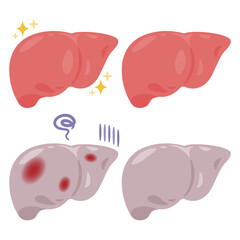 健康でキレイな肝臓と炎症が起きた不健康な肝臓のイラスト