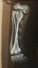 X-ray image of a human leg bone.