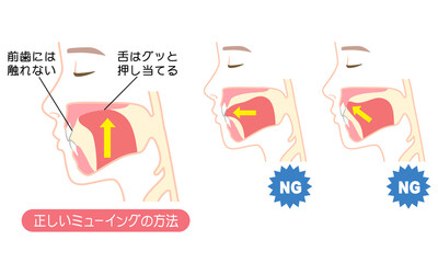 Obraz premium 正しいミューイングの方法 適正な舌の位置と誤った舌の位置
