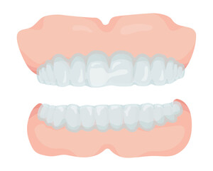 マウスピース上下、正面