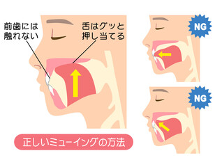 正しいミューイングの方法　適正な舌の位置と誤った舌の位置 © koti