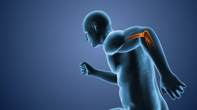 Medical figure depicting elbow pain