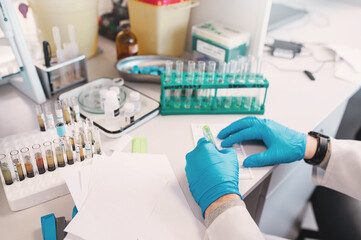 laboratory assistant hands only in disposable sterile gloves makes analyses using pipettes, microscope and records results. Blood in test tubes, test tube stand, reagents, cursors. Closeup no face 