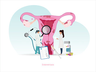 edical representation of endometriosis with doctors evaluating the uterus, highlighting diagnosis, treatment, and symptoms of the gynecological disease.