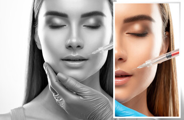 Cosmetologist does injections for lips augmentation and anti wrinkle in the nasolabial folds of a...