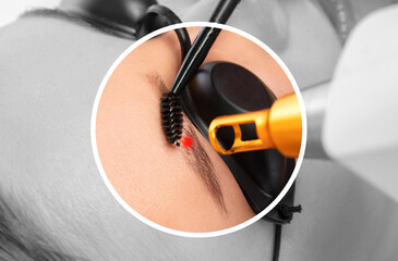 Removal of permanent makeup of a woman.Carbon face peeling in a beauty salon. Hardware cosmetology...