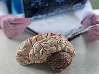 Doctor examining MRI images of patient with multiple sclerosis concept