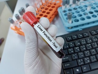 Lab Technologist hold blood sample for Liver Function test. Laboratory medical testing concept. . 